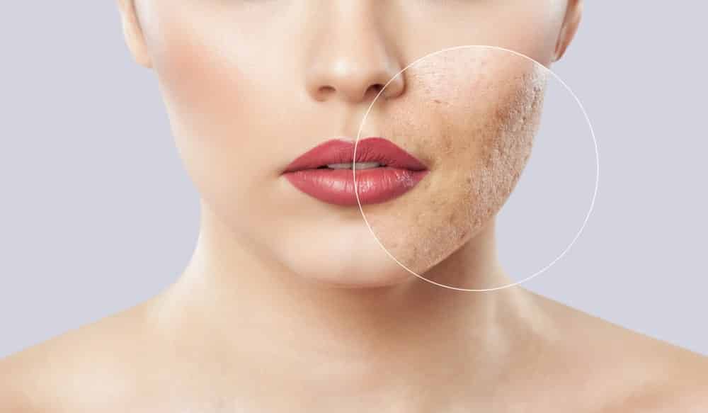 الجلدية والتجميل